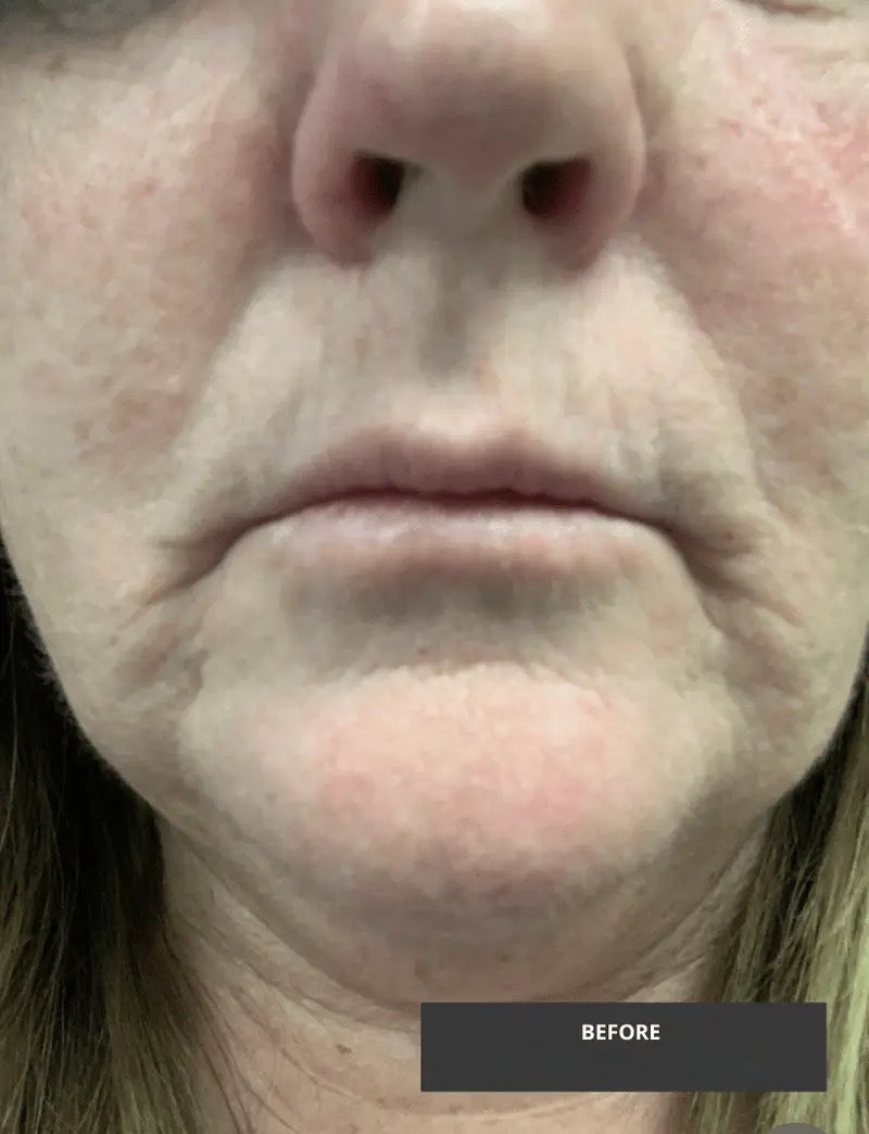 Peptide Face Serum with Argireline & Tripeptides