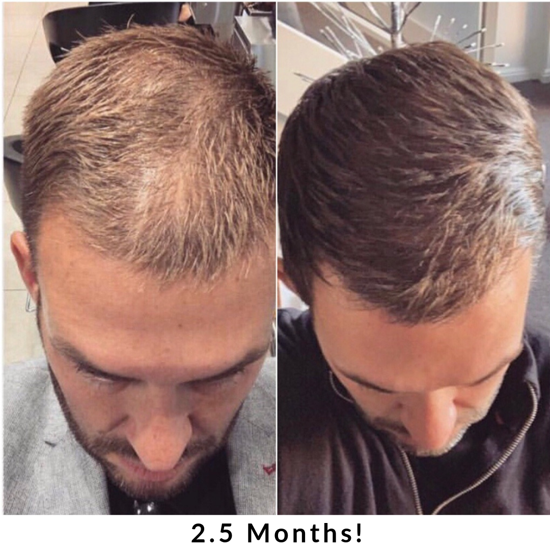 Hair + Energy Formula – Daily Supplement for Nutrient Support