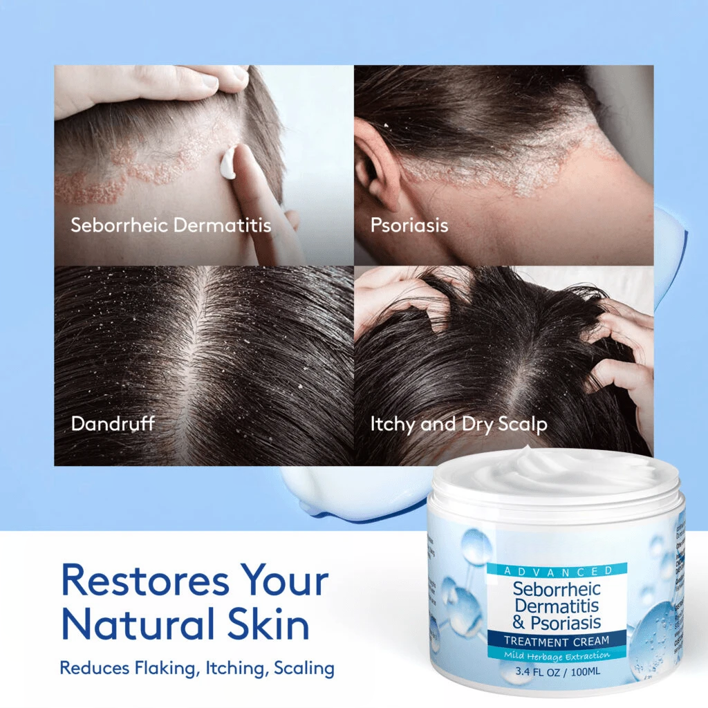 Seborrheic Dermatitis & Psoriasis Cream – Calming Skin Moisturizer