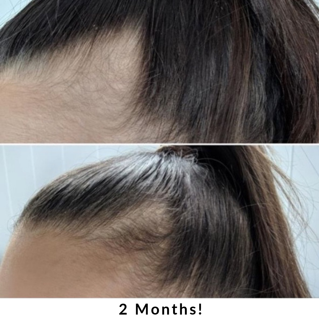 Hair + Energy Formula – Daily Supplement for Nutrient Support