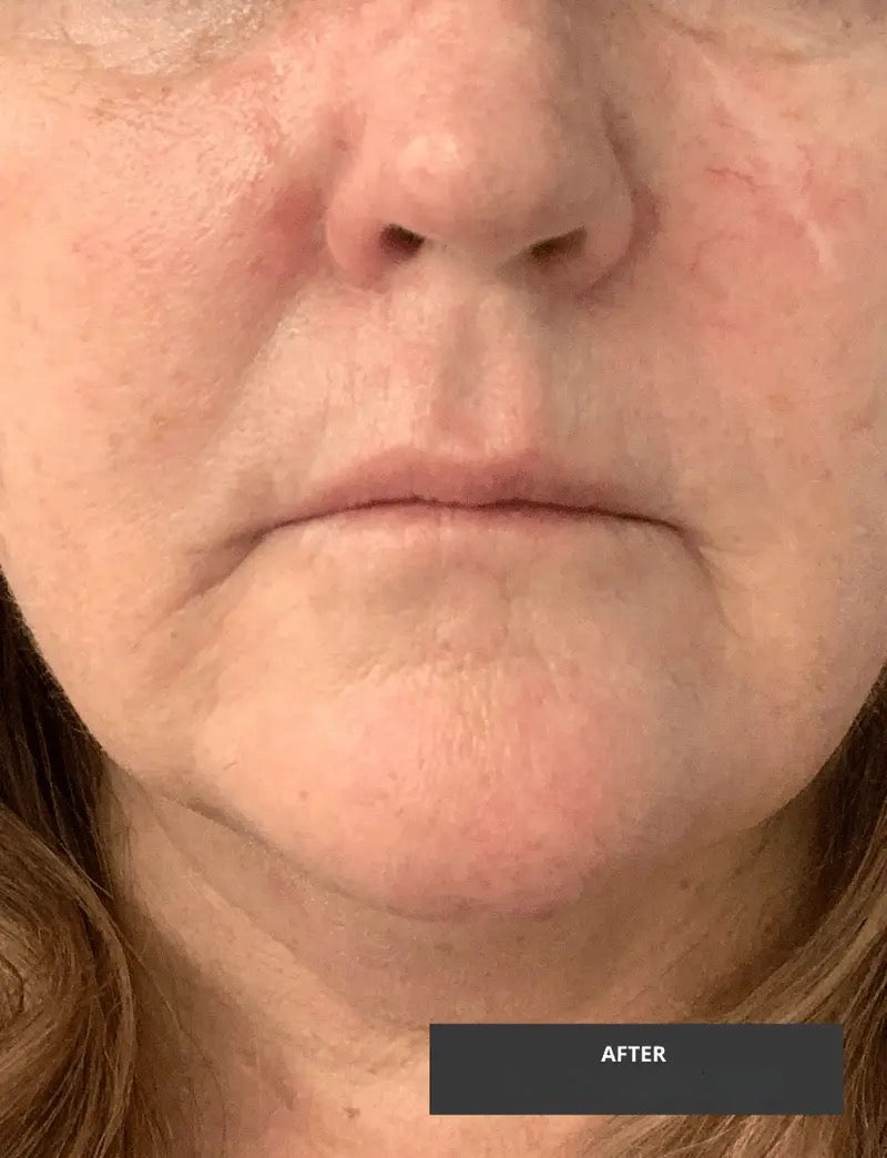 Peptide Face Serum with Argireline & Tripeptides