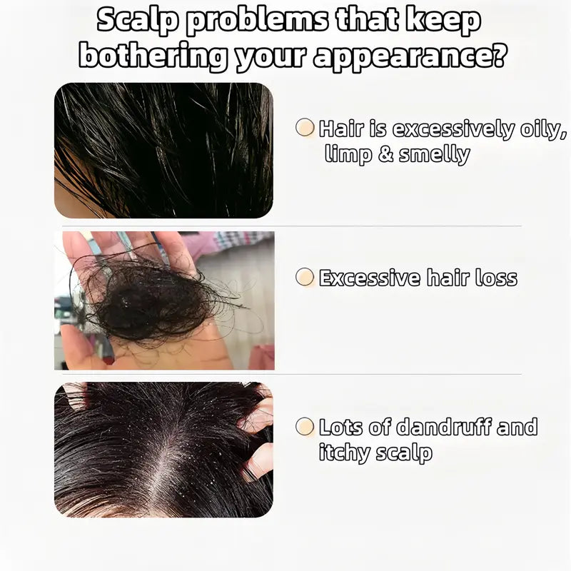 Anti Hair Loss Shampoo – Hair Growth & Moisture Support, 8oz