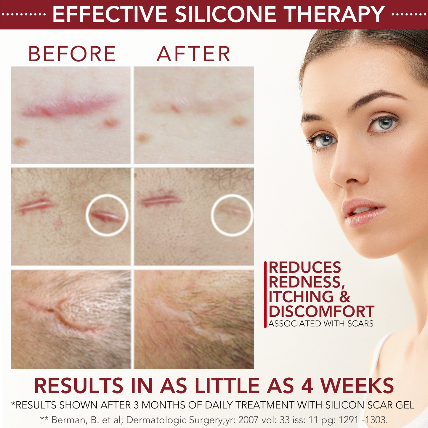 Silicone Scar Gel – Physician Formulated Sheeting, 30g
