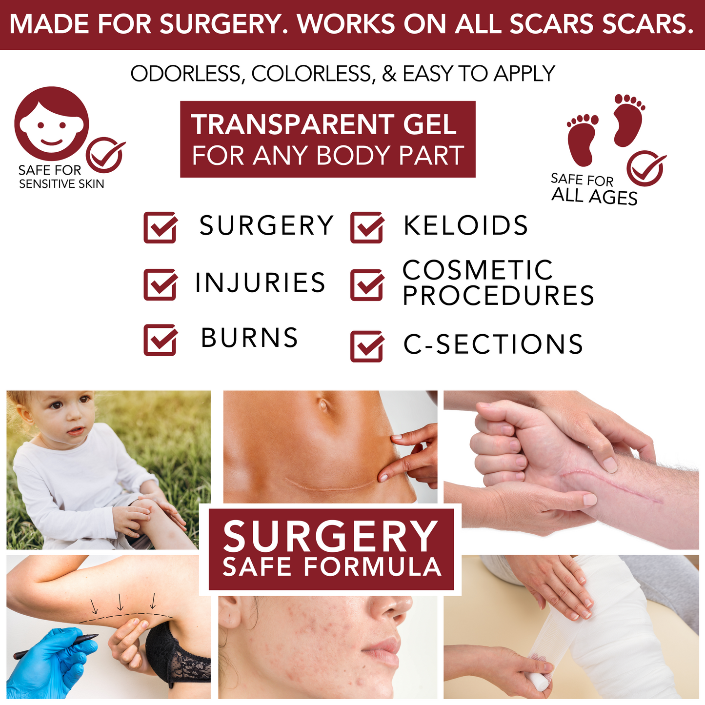 Silicone Scar Gel – Physician Formulated Sheeting, 30g