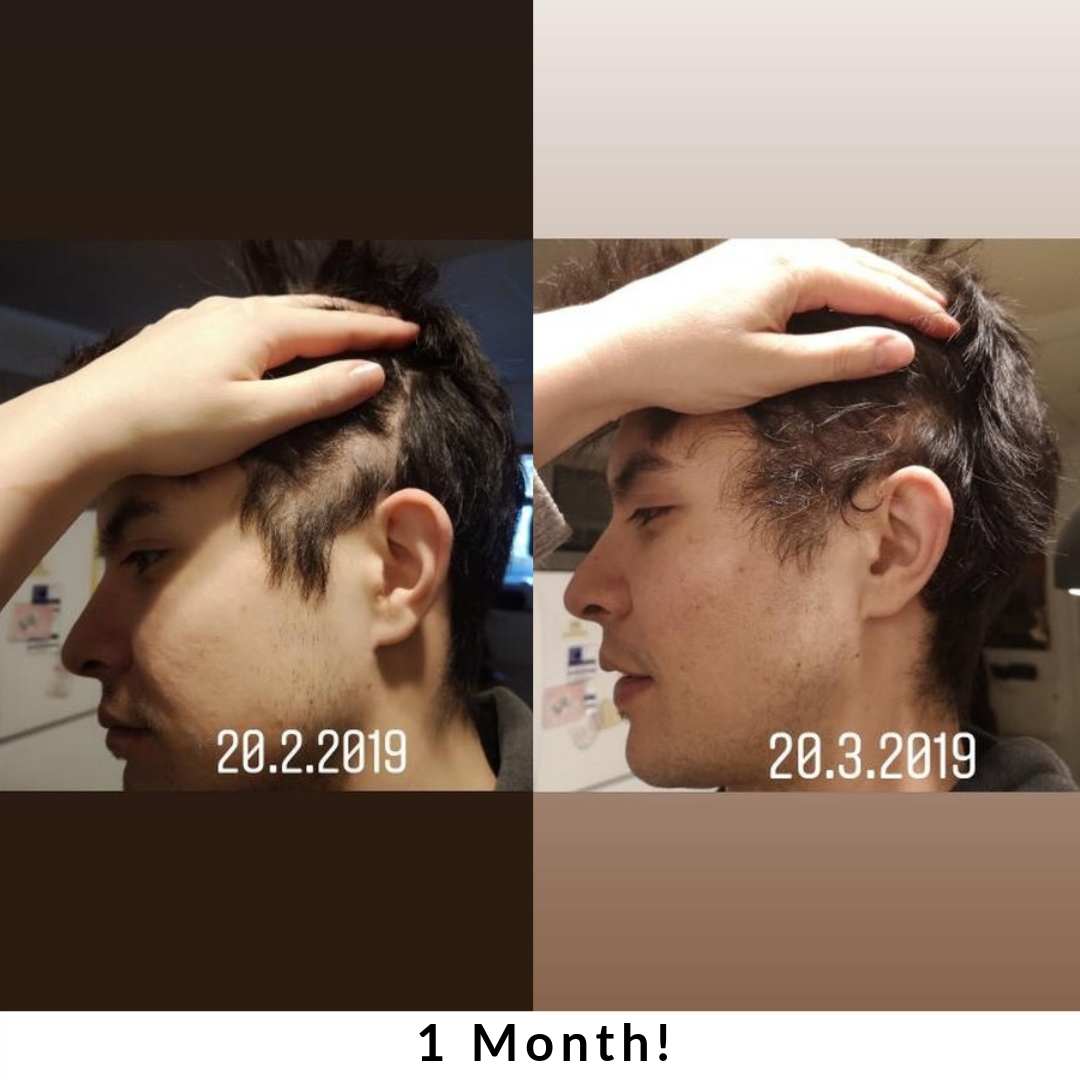 Hair + Energy Formula – Daily Supplement for Nutrient Support