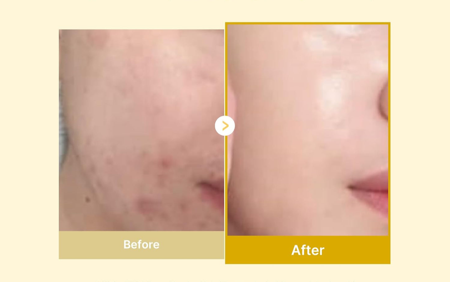 Kojic Acid Turmeric Overnight Peel Off Mask – Korean Skincare