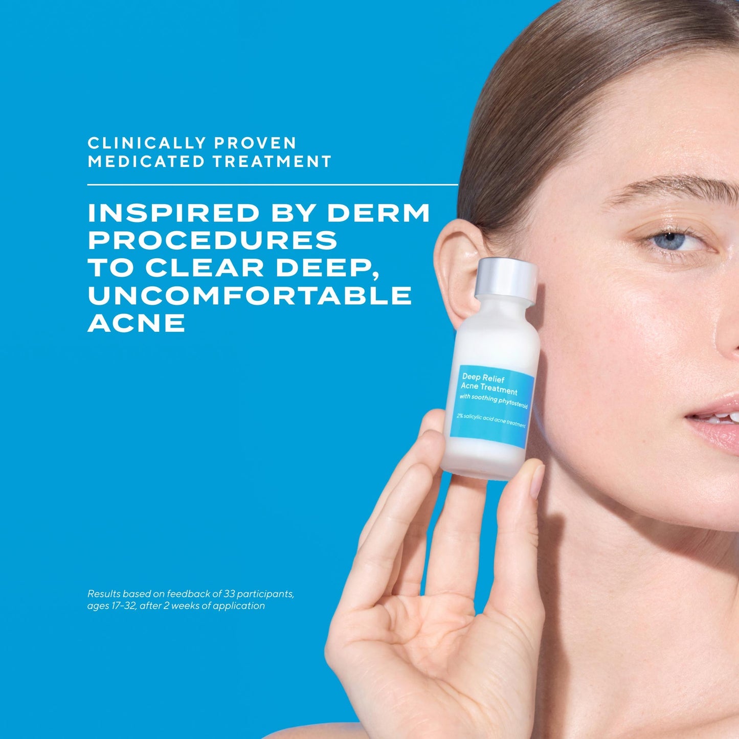 Deep Relief Acne Treatment – Clarifying Facial Formula, 1 oz