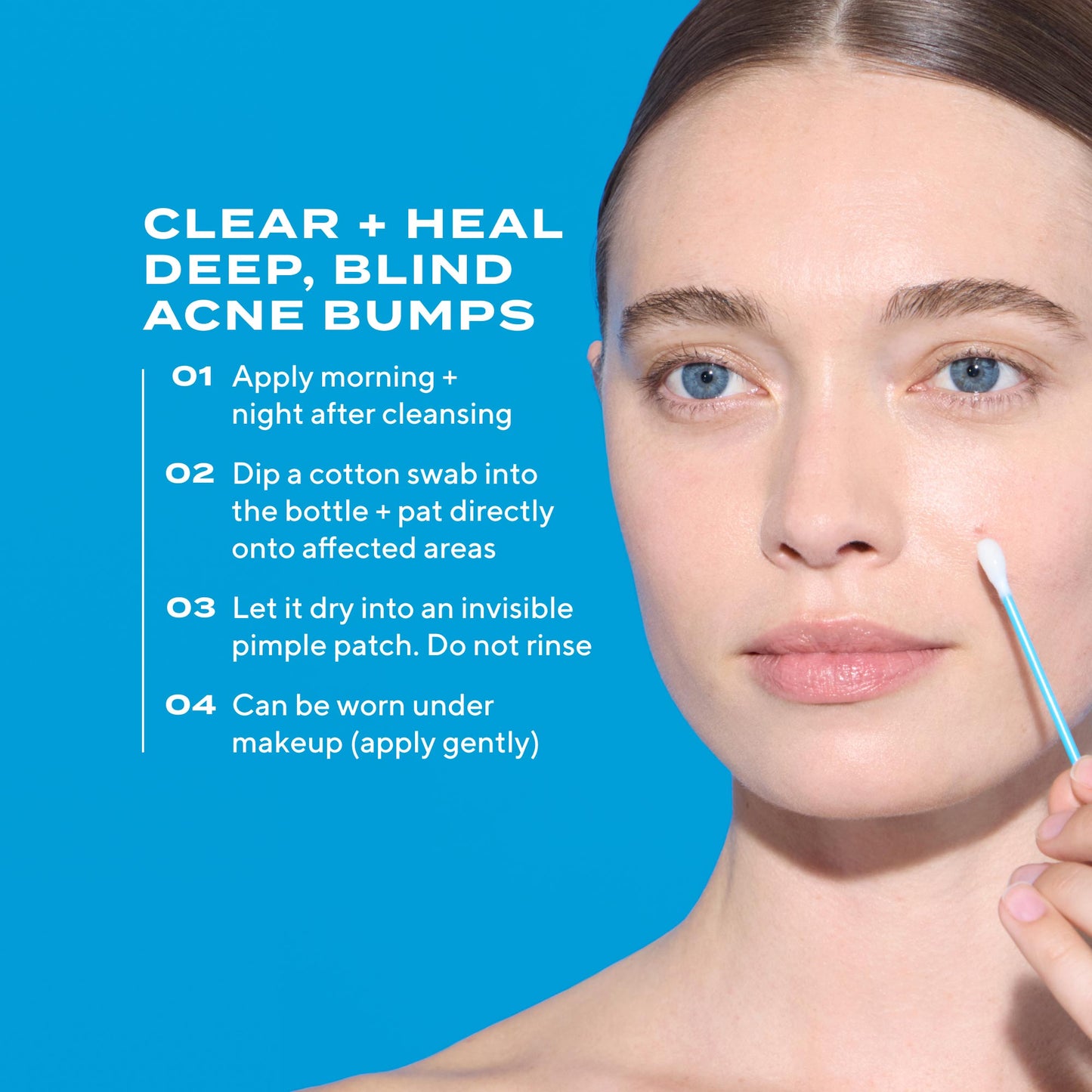 Deep Relief Acne Treatment – Clarifying Facial Formula, 1 oz