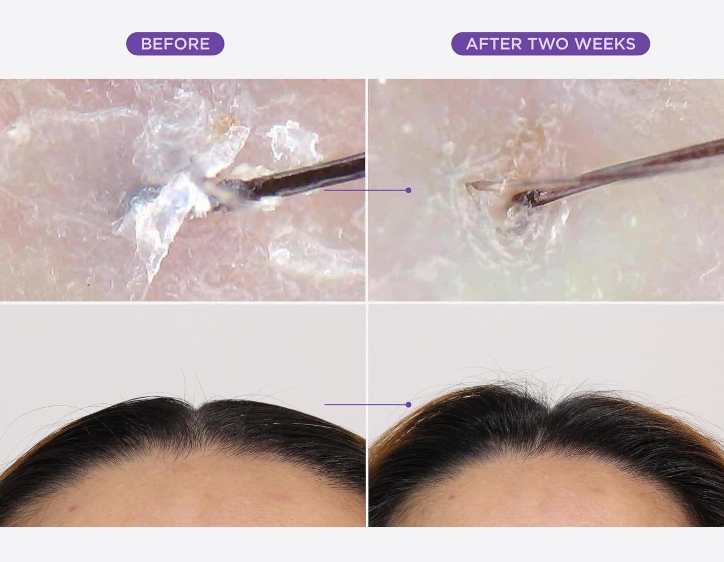Miracle in Shower Treatment Hair Rinse – Korean Moisture & Scalp Revitalizing Solution