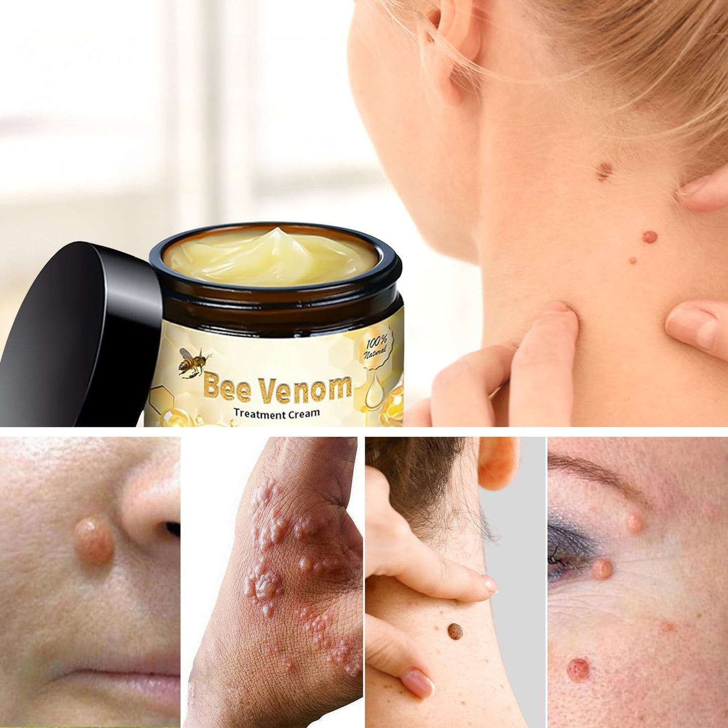 Bee Venom Skin Care Cream – Deep Hydration & Skin-Smoothing Moisturizer for All Skin Types