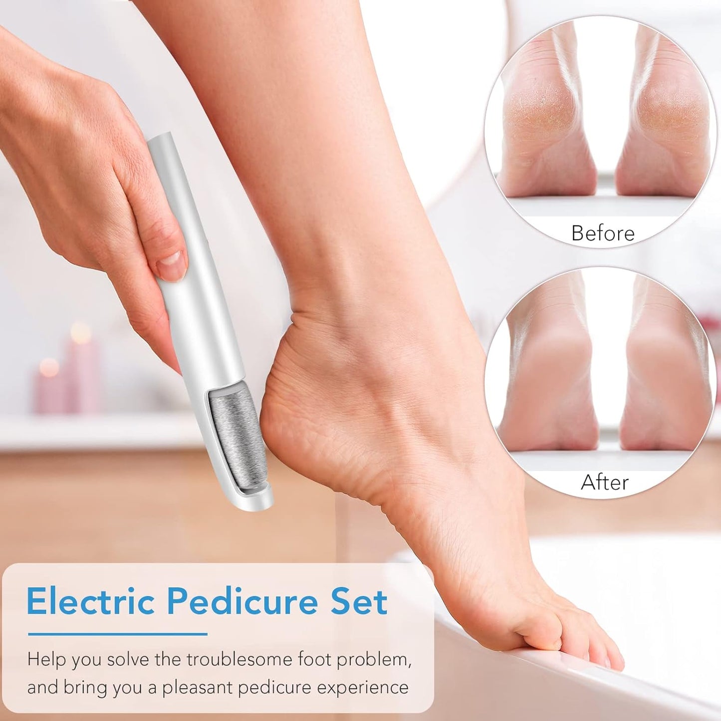 Linkevap Electric Callus Remover – Foot Scrubber Kit, White