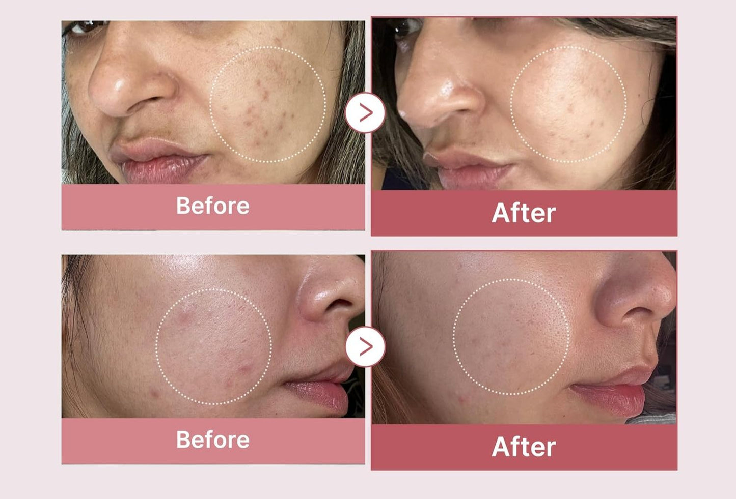 PDRN Pink Peptide Serum – Salmon + Rose PDRN