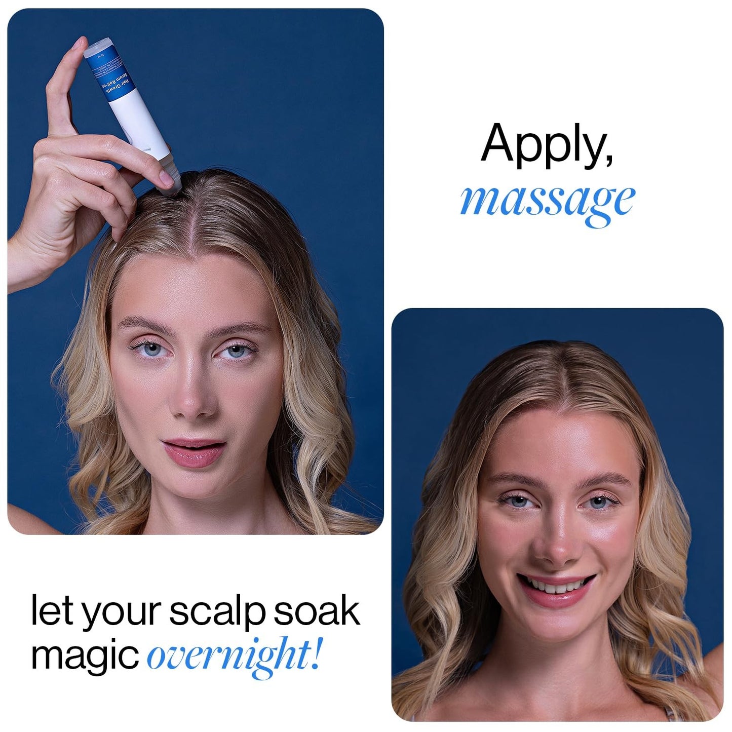 Rosemary Scalp Serum Roll-On – Redensyl & Anagain, 25 ml