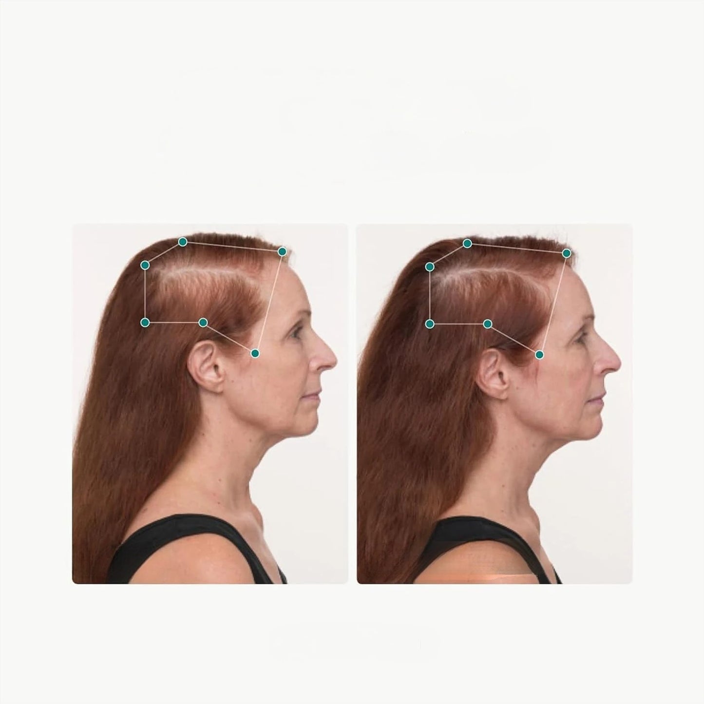 Women's Balance Hair Growth Supplements, Ages 45 and Up