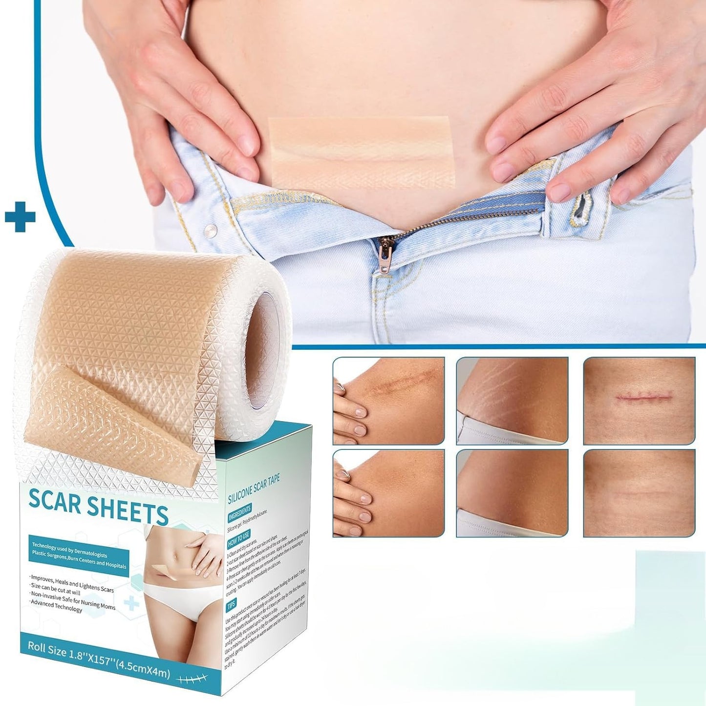 Silicone Scar Sheets – Soft Tape Roll for Scar Care