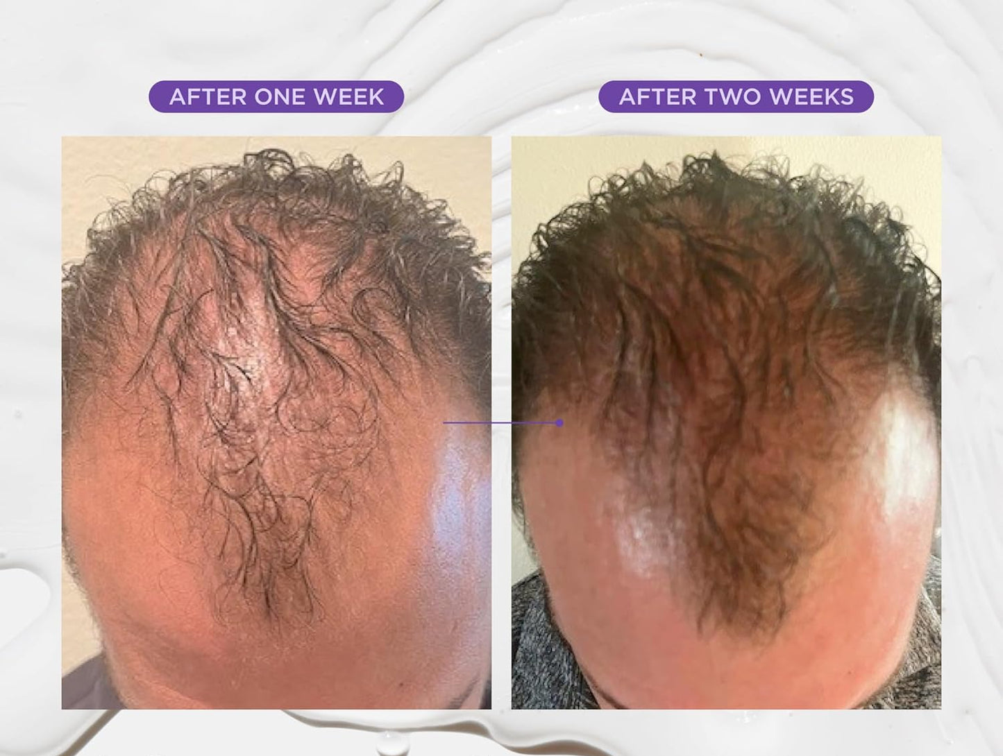 Miracle in Shower Treatment Hair Rinse – Korean Moisture & Scalp Revitalizing Solution