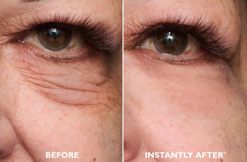 Instant FirmX Easy Wear Eye Tightener – Temporary Firming Gel