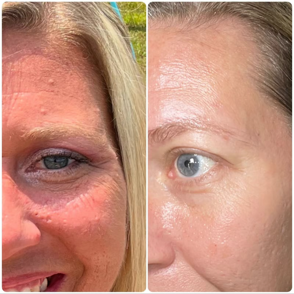 Peptide Face Serum with Argireline & Tripeptides