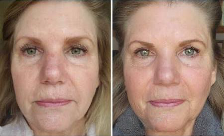 Glyco-Peptide Anti Wrinkle Face Cream – Hydrating Moisturizer