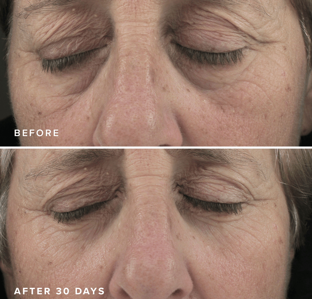 Brightening Eye Masks – Hydrating Under Eye Patches