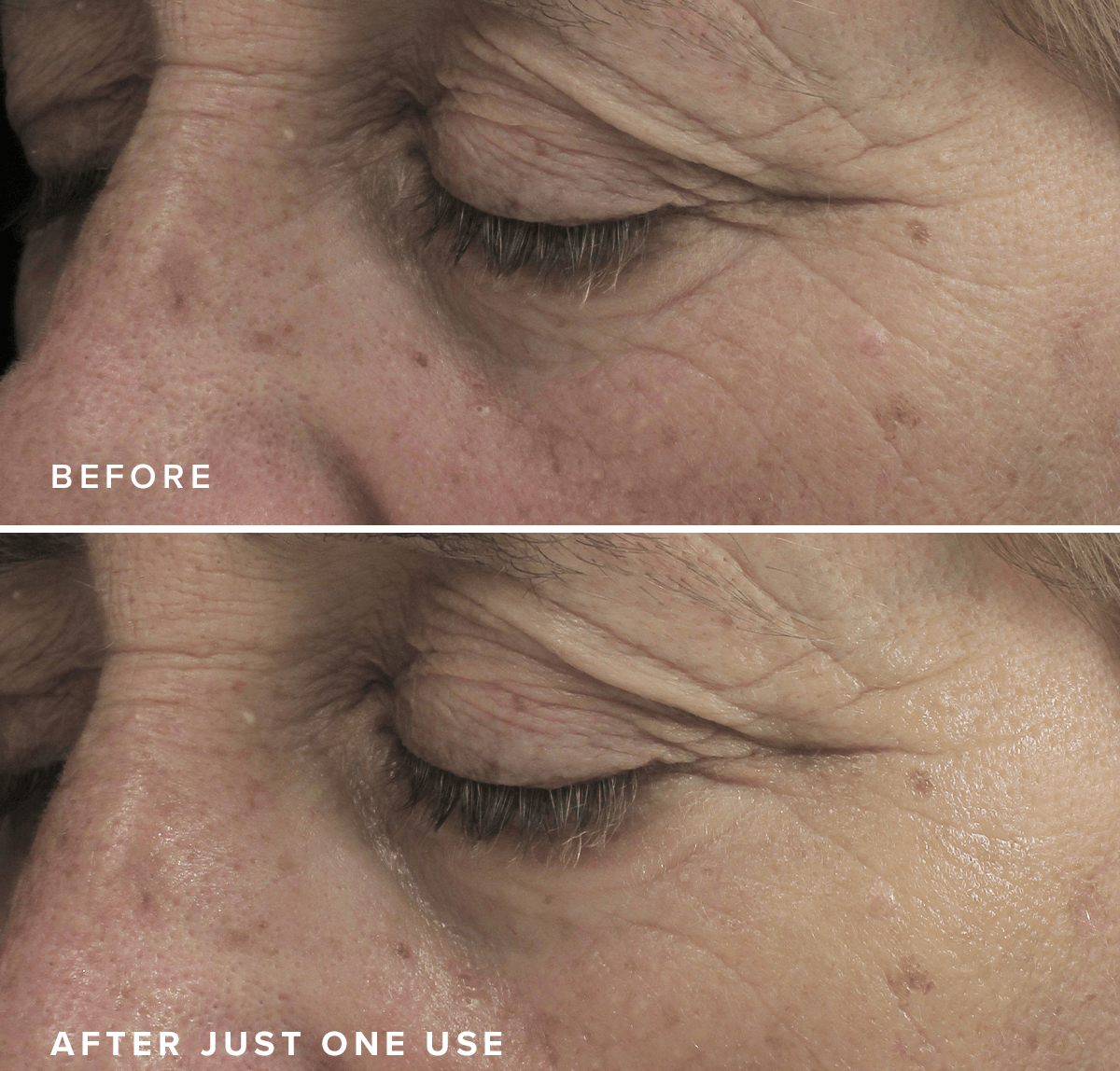 Brightening Eye Masks – Hydrating Under Eye Patches