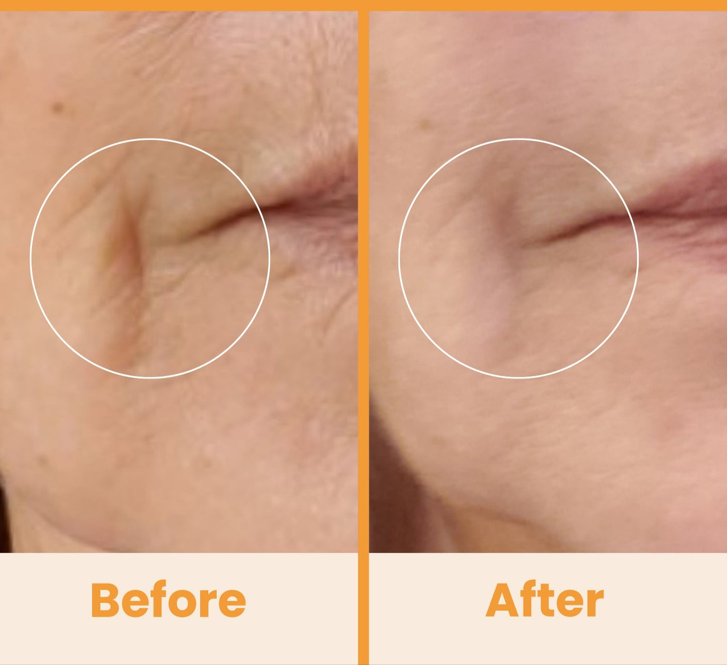 NuDerma Standard High Frequency Wand – Facial Skincare Tool