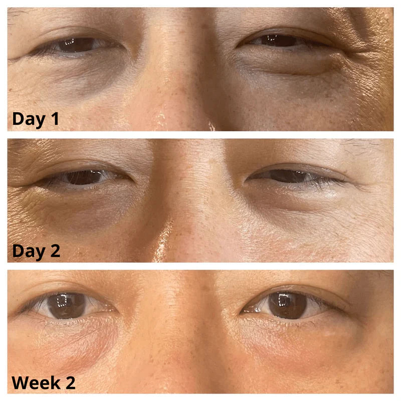 Caffeine Eye Cream – Lightweight Under Eye Moisturizer