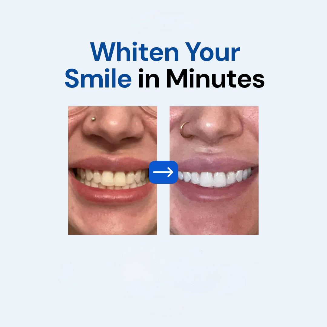 Dissolving Teeth Whitening Strips with Hydroxyapatite - Easy, Enamel-Safe Whitening Solution