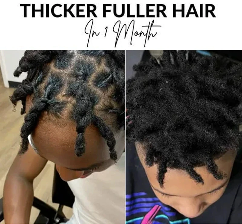 Scalp Stimulator – Hair Growth Oil for Stronger, Healthier Hair
