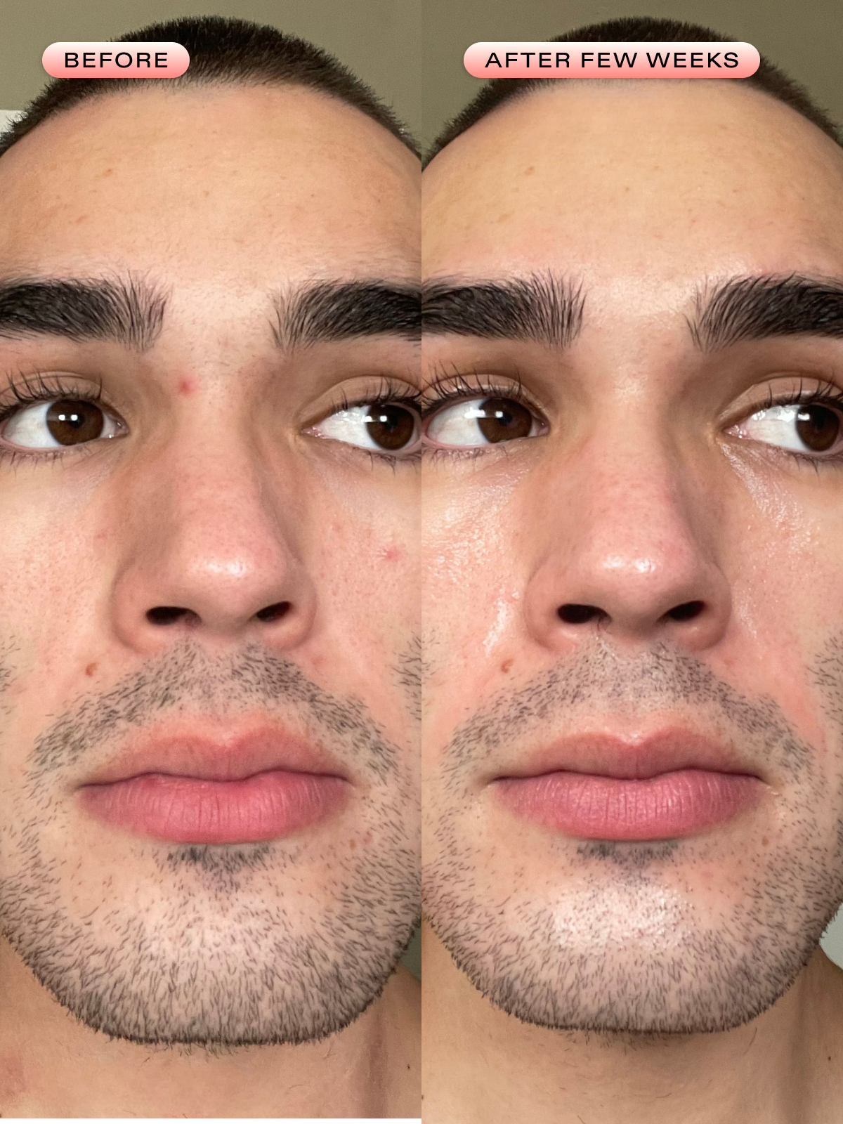 Oil La La Balancing Serum – Clarifying Face Serum for Oily Skin