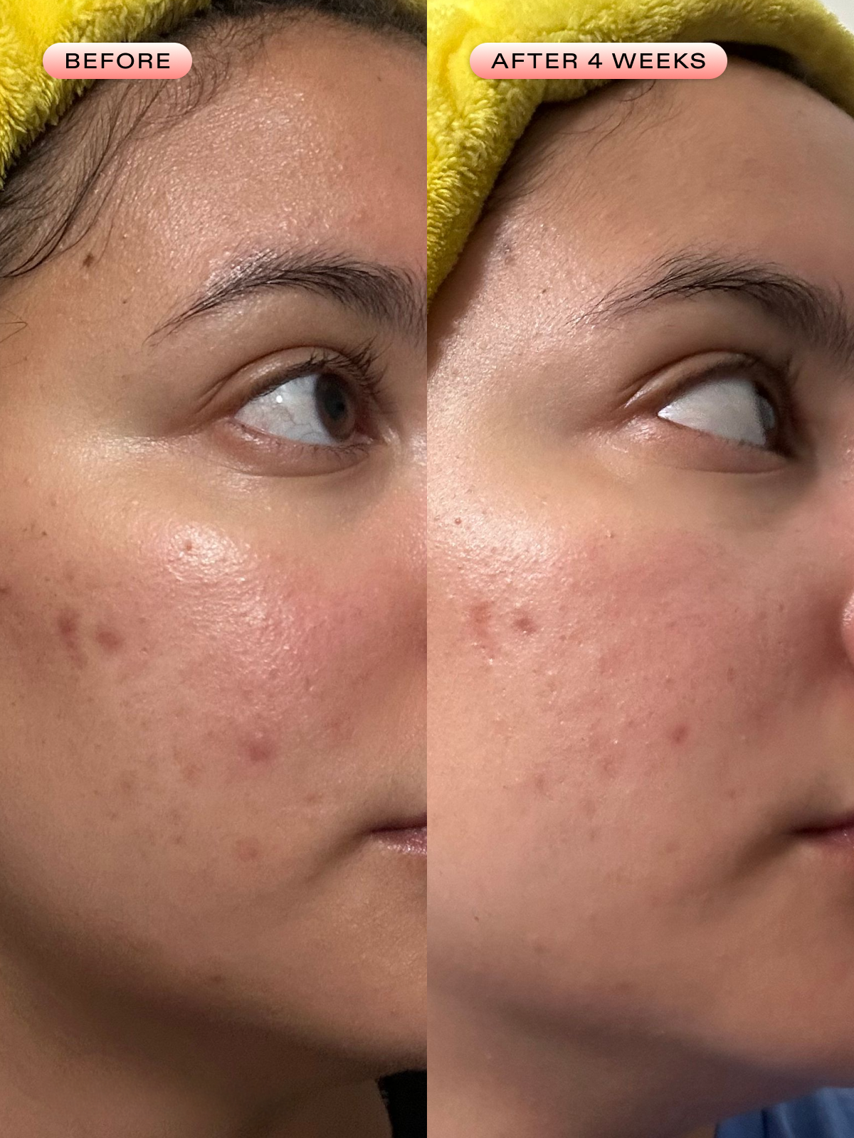Oil La La Balancing Serum – Clarifying Face Serum for Oily Skin