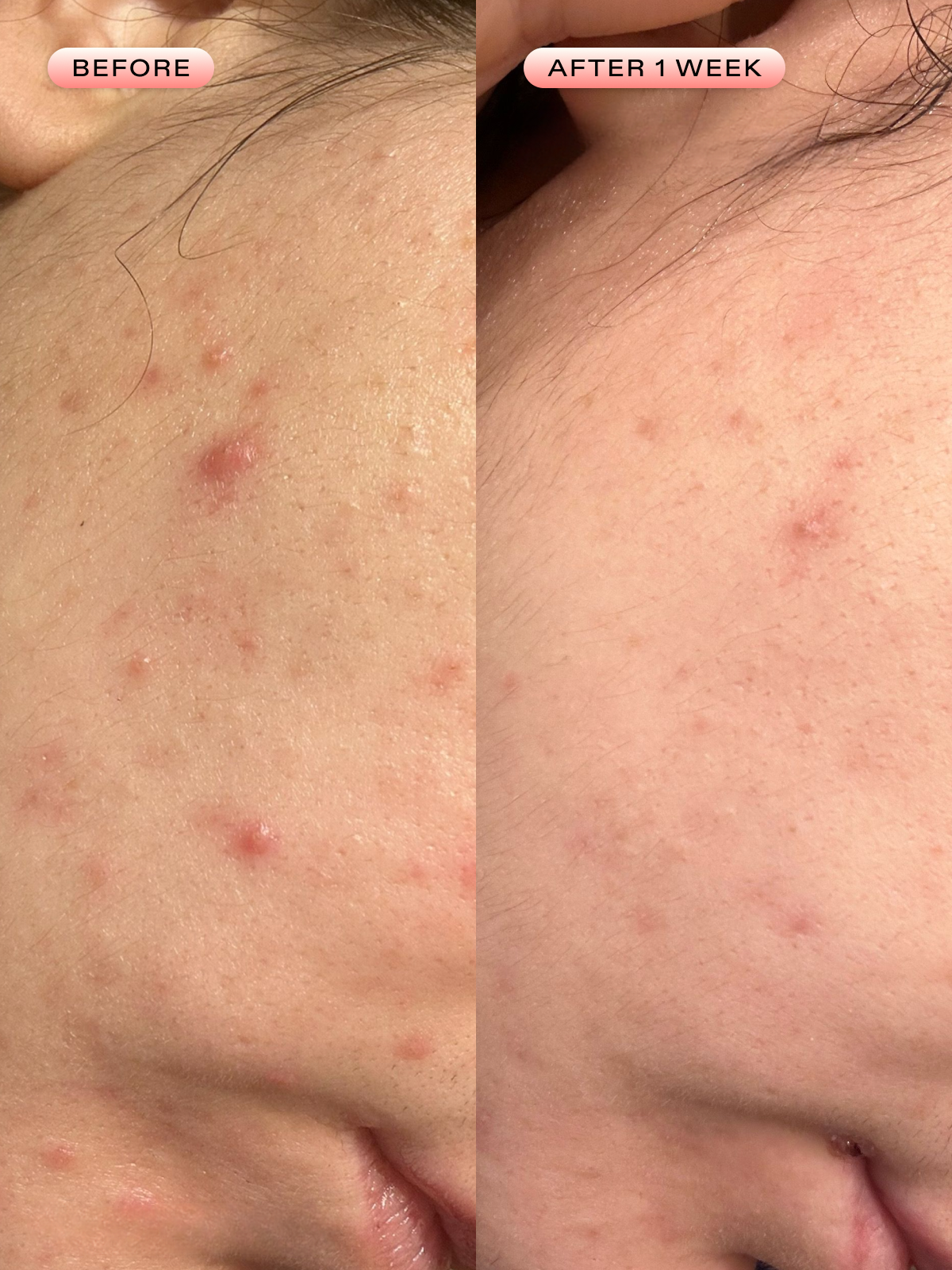 Oil La La Balancing Serum – Clarifying Face Serum for Oily Skin