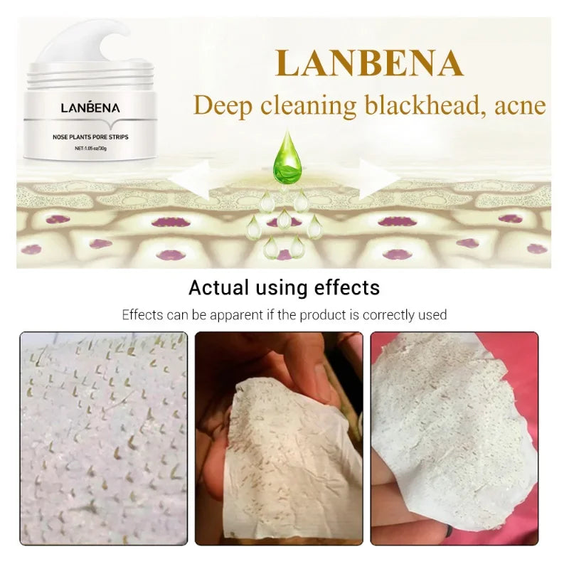 LANBENA Blackhead Remover – Deep Cleansing Nose Mask & Pore Strip