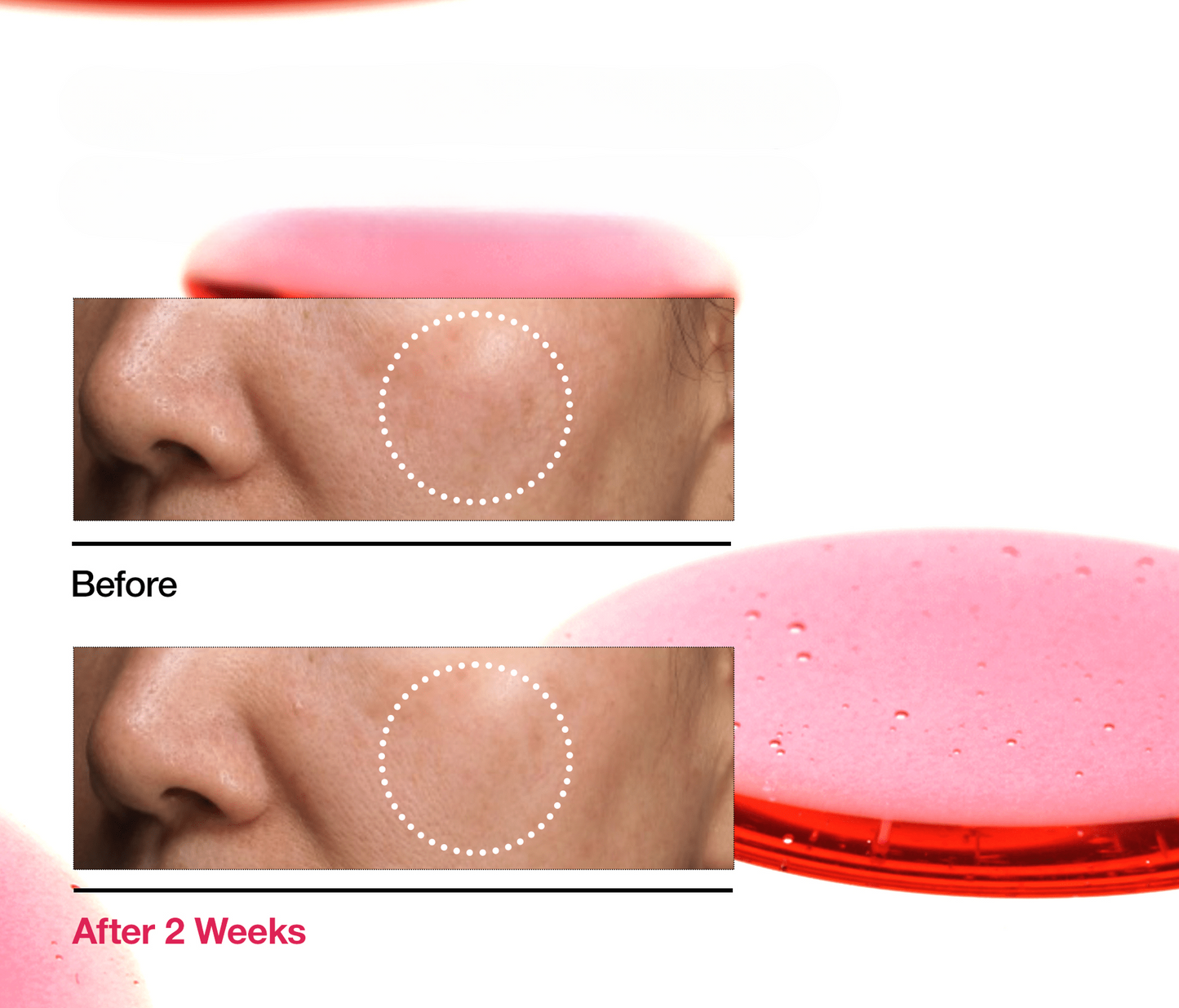Niacinamide 10% + TXA 4% Serum – Daily Skin Balancing Formula