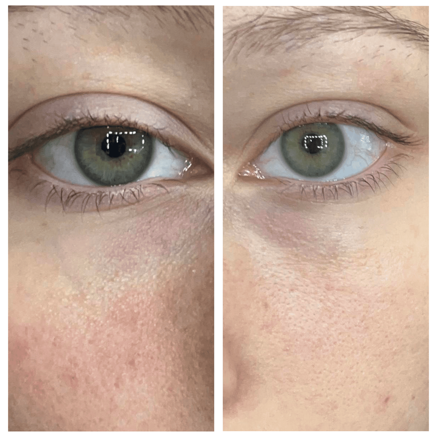 Caffeine Eye Cream – Lightweight Under Eye Moisturizer