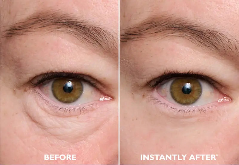 Instant FirmX Easy Wear Eye Tightener – Temporary Firming Gel