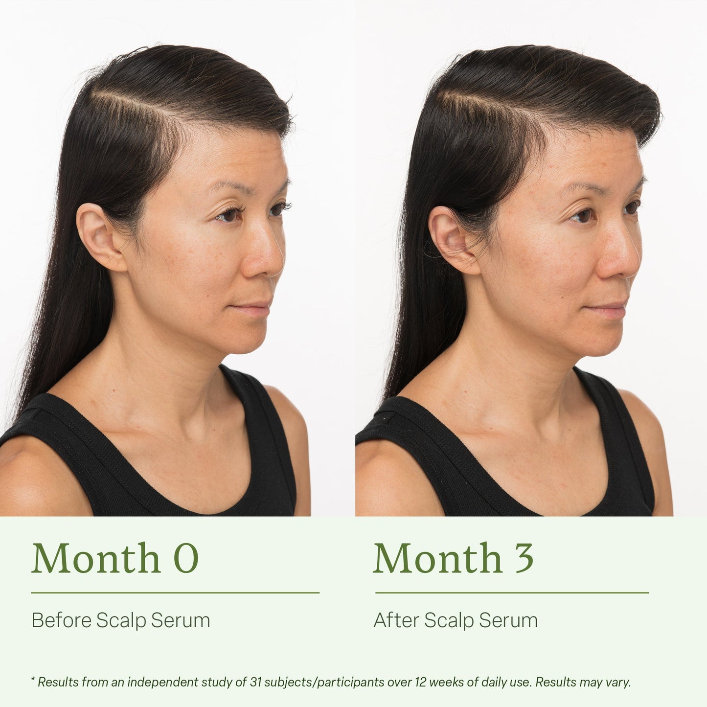 Healthy Scalp & Hair Serum – Lightweight Botanical Formula, 30 ml