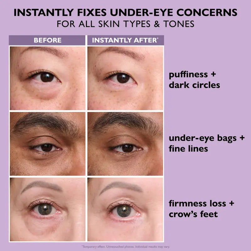 Instant FirmX Easy Wear Eye Tightener – Temporary Firming Gel