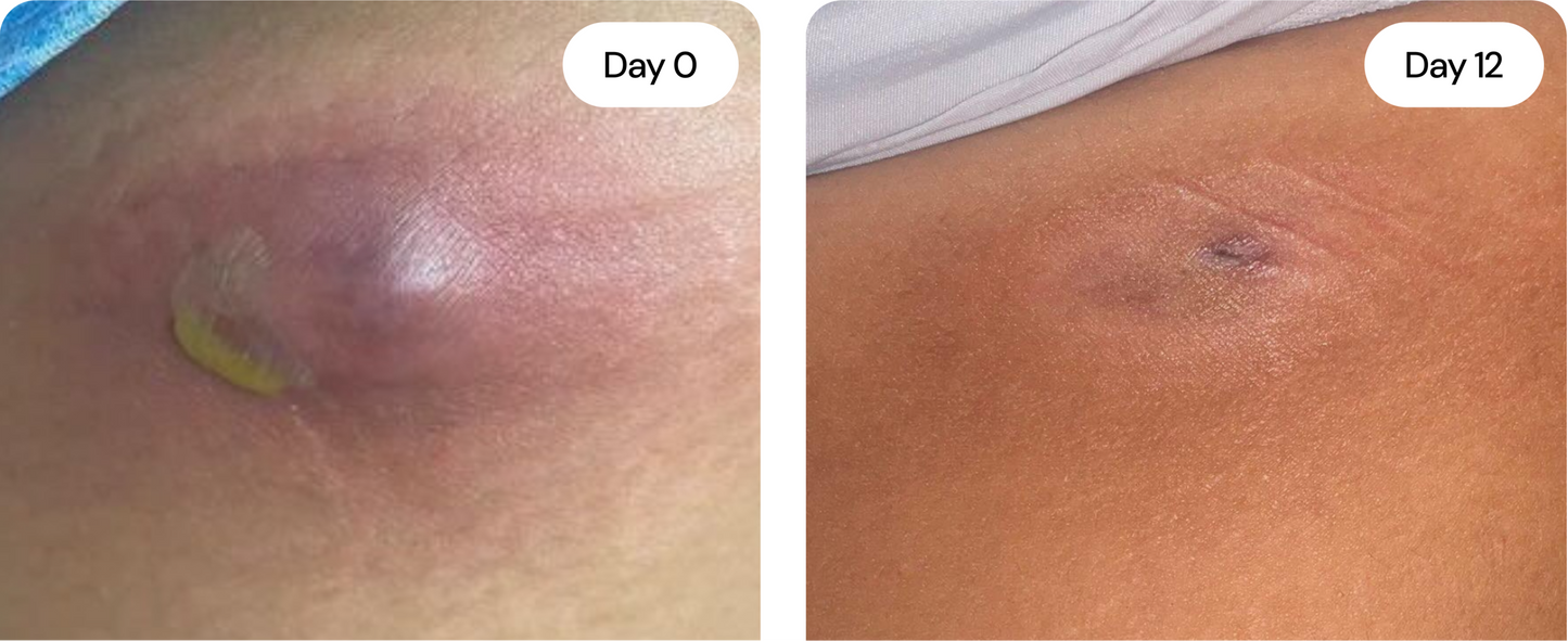 Universal Flare Care – Sensitive Skin Cream with Propolis