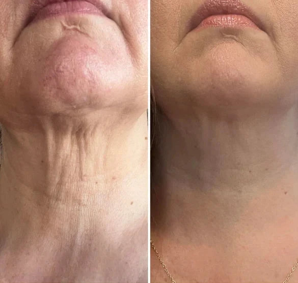 Tighten & Lift Neck Cream - Anti-Aging Neck Firming Cream