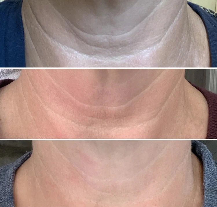 Tighten & Lift Neck Cream - Anti-Aging Neck Firming Cream