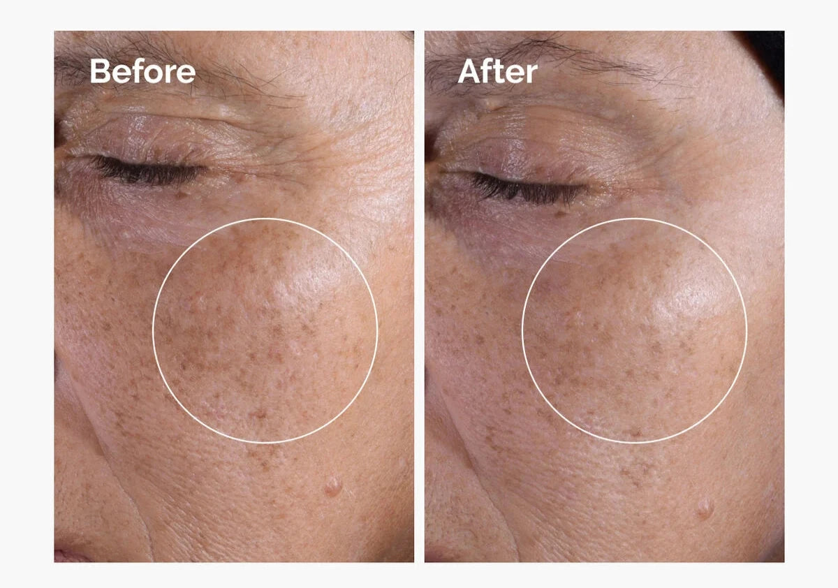 Glycolic Acid 7% Exfoliating Toner – Brighten & Nourish Your Skin
