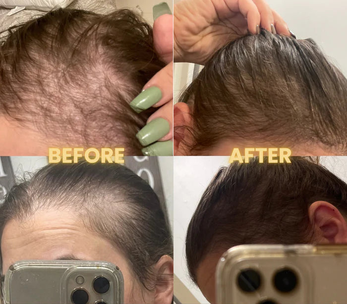 Scalp Stimulator – Hair Growth Oil for Stronger, Healthier Hair