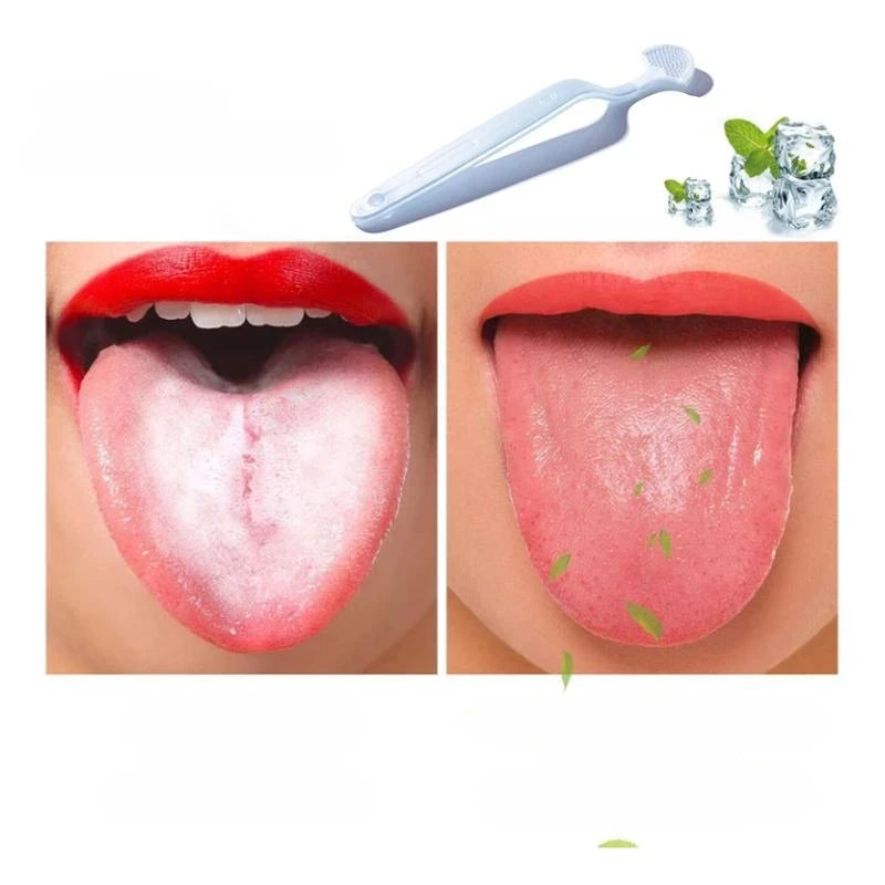 Tongue Cleaning Gel & Brush Set – Mint Freshener & Cleanser