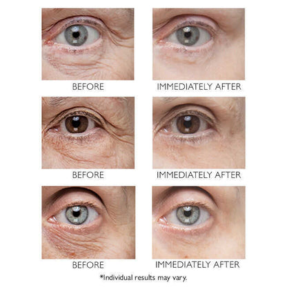 Temporary Eye Tightener – Smoothing Eye Serum, 1.5 oz