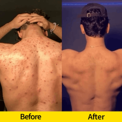 Lemon Turmeric Kojic Acid Soap – Brightening Face & Body Bar