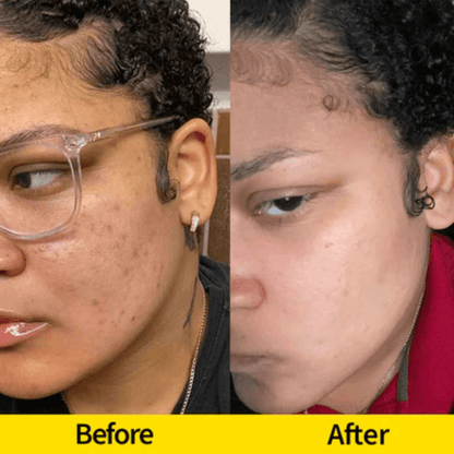 Lemon Turmeric Kojic Acid Soap – Brightening Face & Body Bar