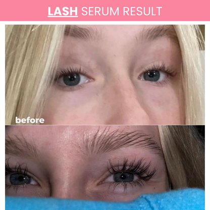 Lash & Brow Serum Duo – Natural Growth for Thicker, Darker Lashes