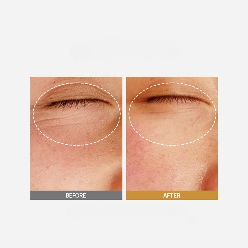 Deep Collagen Anti-Wrinkle Serum – Hydrating Skin Treatment
