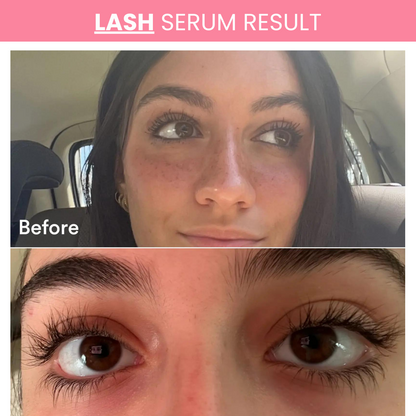 Lash & Brow Serum Duo – Natural Growth for Thicker, Darker Lashes